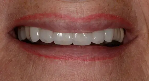 Case 1