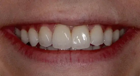Case 4