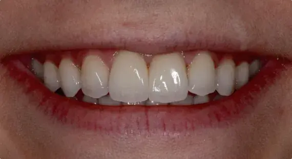 Case 4