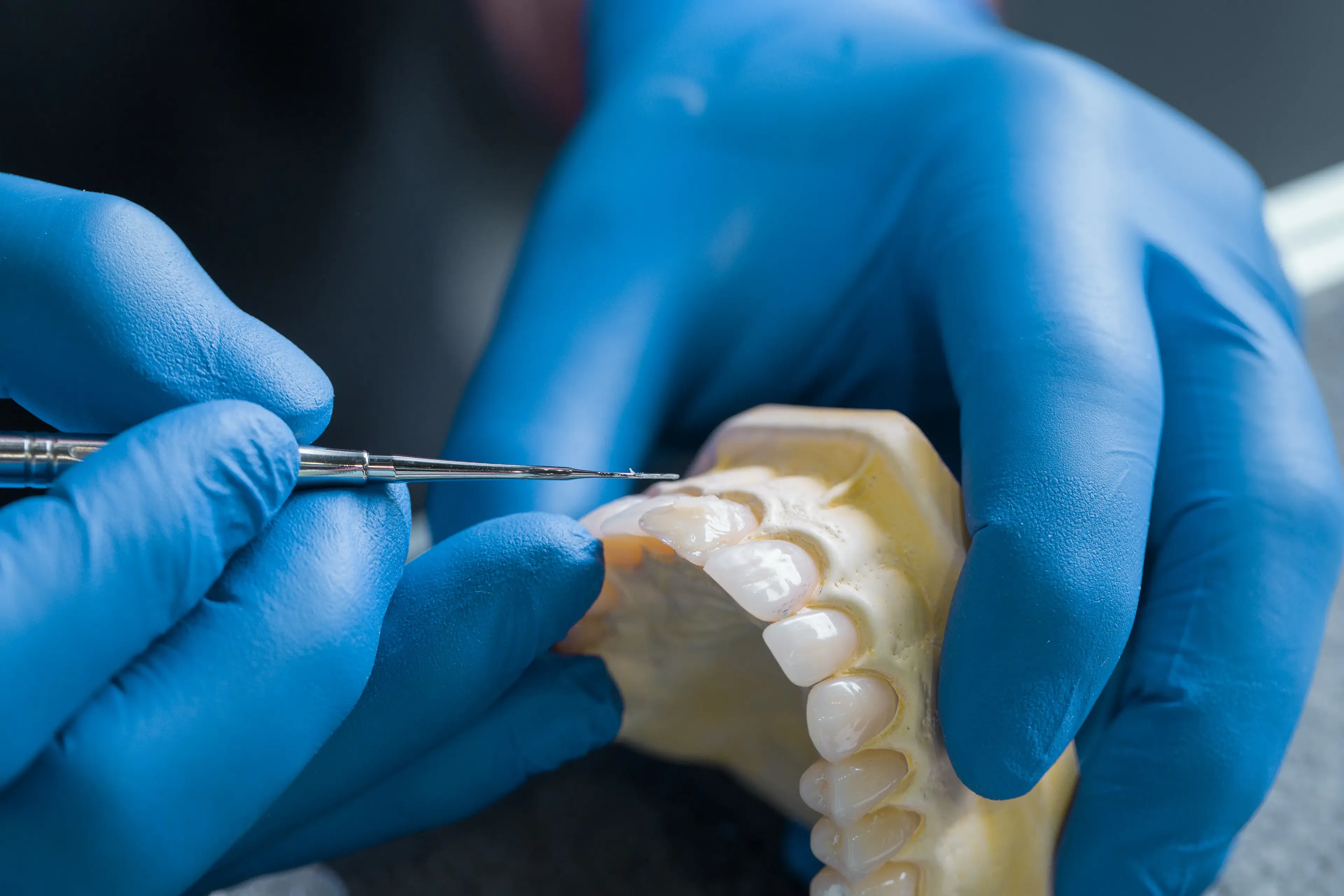 Precision dental ceramics — hand-layered porcelain