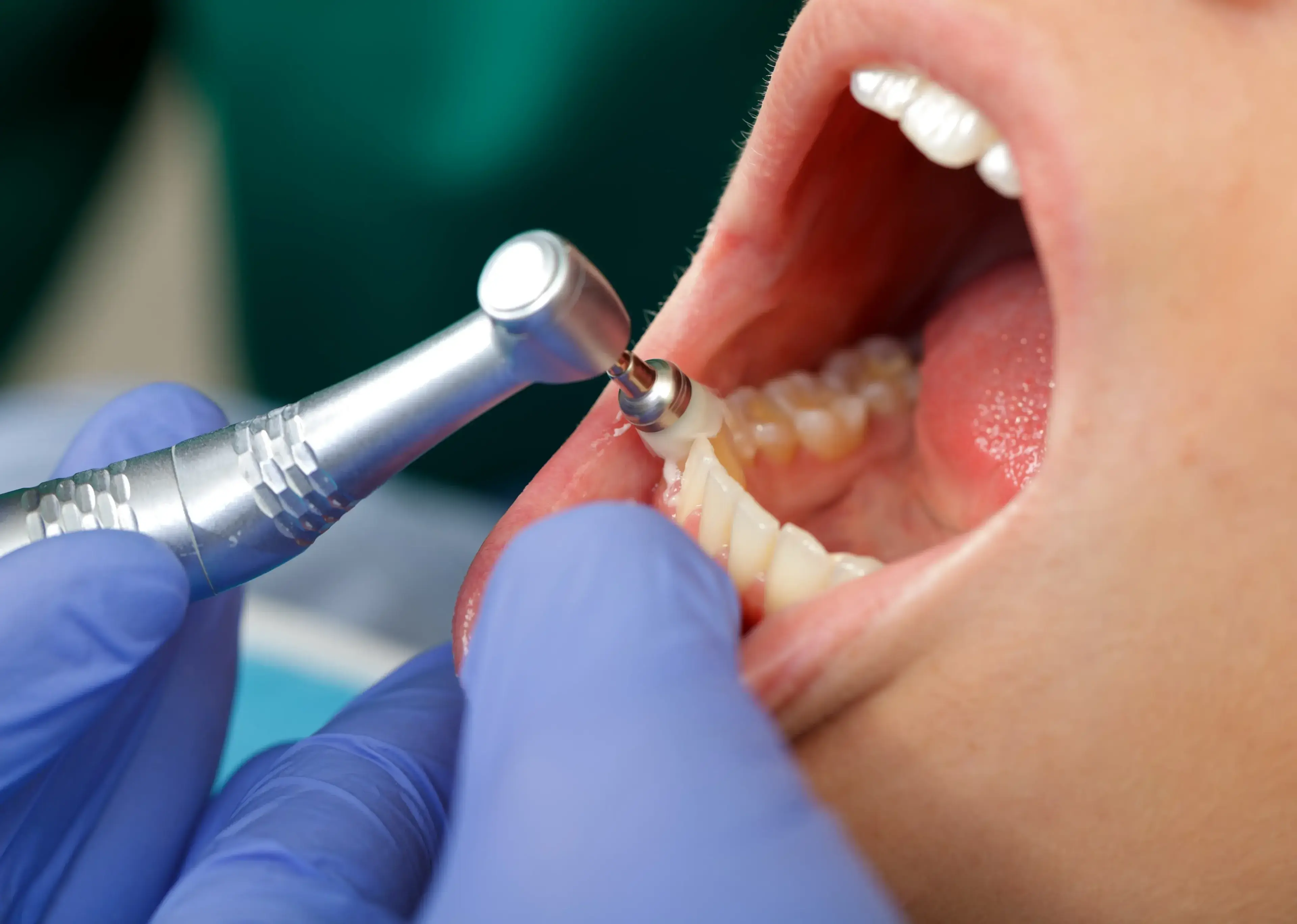 Prevention and prophylaxis