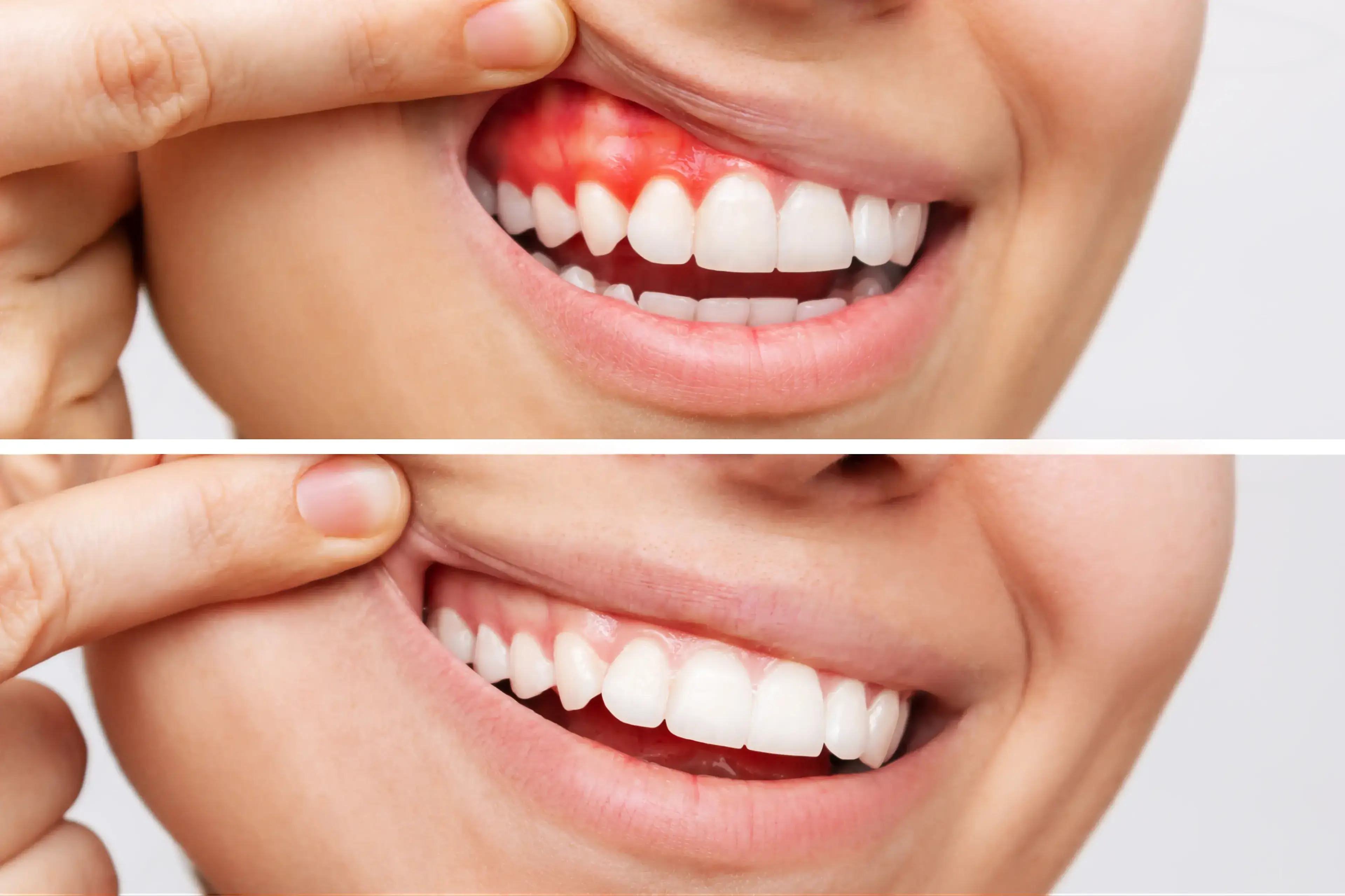 Periodontal care — gum health